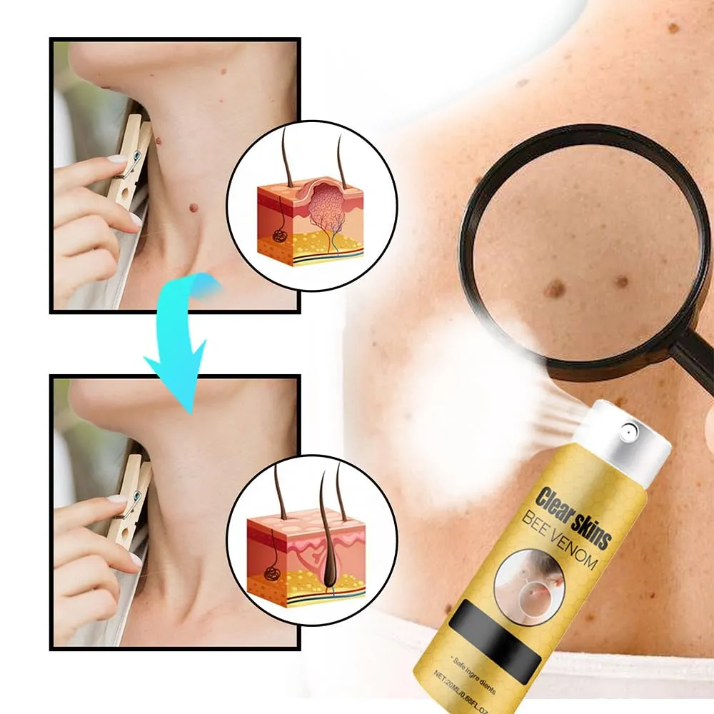 3pcs Bee Venom Spray, Smooth Skin Deep Moisturizing Suitable for All Skin Types of Men and Women