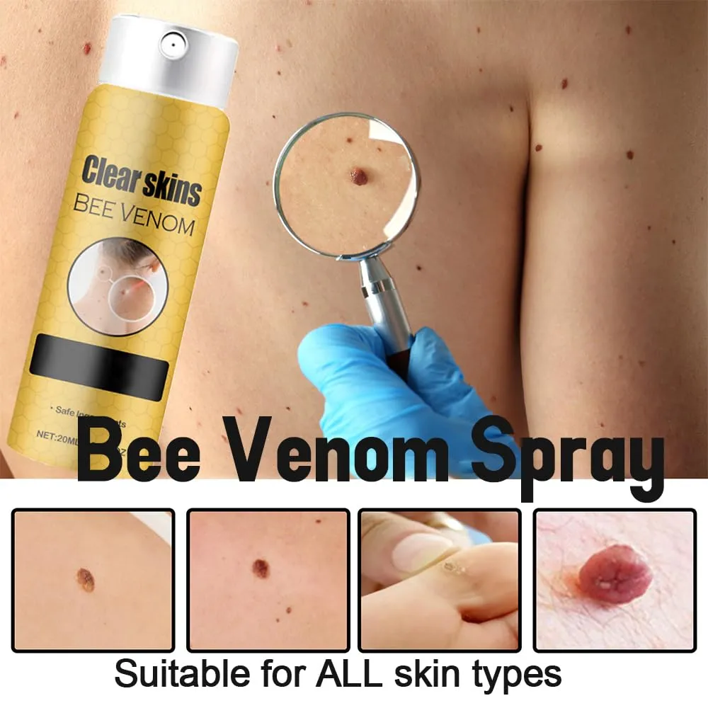 3pcs Bee Venom Spray, Smooth Skin Deep Moisturizing Suitable for All Skin Types of Men and Women