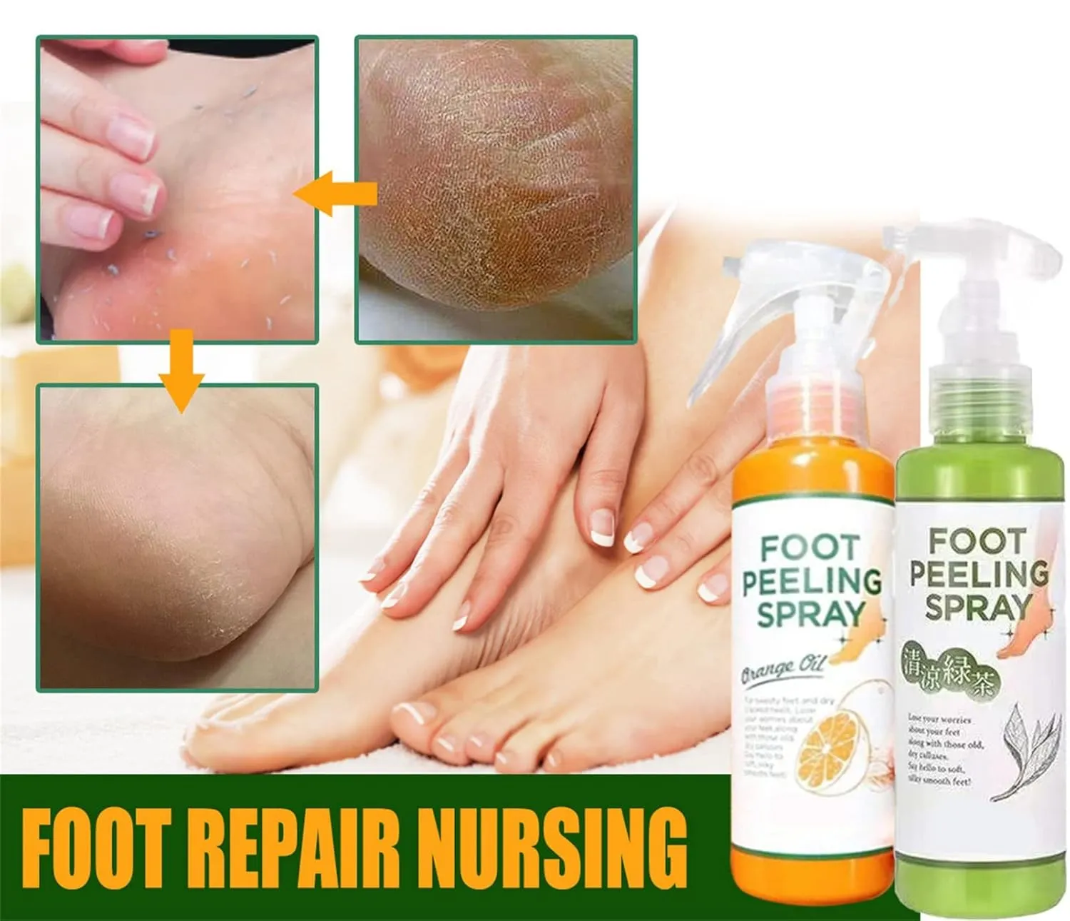Foot Peeling Spray Orange Oil,Foot Peeling Spray That Remove Dead Skin,Remove Dead Skin within Seconds,Hydrating Nourish Peel Off Spray,Exfoliating Peeling & Calluses on Feet 110 ML (Green Orange)
