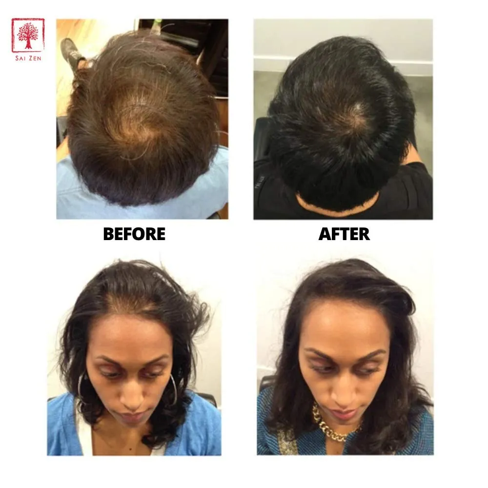 Volume Plus Scalp Therapy Spray | Post-Shower Hair Strengthening Formula | Made in USA | Alcohol and Paraben Free, 2 oz.